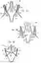 Fig. 03 - Sinus-engaging valve fixation member