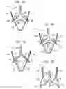 Fig. 04 - Sinus-engaging valve fixation member