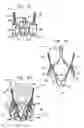Fig. 05 - Sinus-engaging valve fixation member