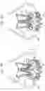 Fig. 12 - Sinus-engaging valve fixation member