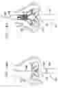 Fig. 22 - Sinus-engaging valve fixation member