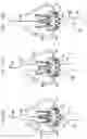 Fig. 24 - Sinus-engaging valve fixation member