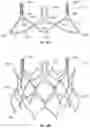 Fig. 27 - Sinus-engaging valve fixation member
