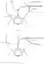 Fig. 09 - Heart valve therapeutic device