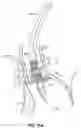 Fig. 33 - DEVICES, SYSTEMS AND METHODS TO IMPROVE PLACEMENT AND/OR PREVENT HEART BLOCK WITH PERCUTANEOUS AORTIC VALVE REPLACEMENT