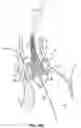 Fig. 41 - DEVICES, SYSTEMS AND METHODS TO IMPROVE PLACEMENT AND/OR PREVENT HEART BLOCK WITH PERCUTANEOUS AORTIC VALVE REPLACEMENT