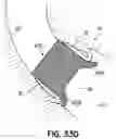 Fig. 71 - DEVICES, SYSTEMS AND METHODS TO IMPROVE PLACEMENT AND/OR PREVENT HEART BLOCK WITH PERCUTANEOUS AORTIC VALVE REPLACEMENT