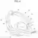 Fig. 07 - Side-deliverable transcatheter prosthetic valves and methods for delivering and anchoring the same