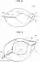 Fig. 08 - Side-deliverable transcatheter prosthetic valves and methods for delivering and anchoring the same
