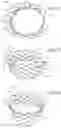Fig. 09 - Side-deliverable transcatheter prosthetic valves and methods for delivering and anchoring the same