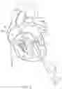 Fig. 03 - Apical Control Of Transvascular Delivery Of Prosthetic Mitral Valve