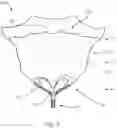 Fig. 08 - Apical Control Of Transvascular Delivery Of Prosthetic Mitral Valve