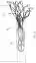 Fig. 22 - Apical Control Of Transvascular Delivery Of Prosthetic Mitral Valve