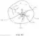Fig. 40 - Apical Control Of Transvascular Delivery Of Prosthetic Mitral Valve