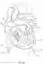 Fig. 41 - Apical Control Of Transvascular Delivery Of Prosthetic Mitral Valve