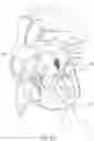 Fig. 43 - Apical Control Of Transvascular Delivery Of Prosthetic Mitral Valve