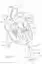 Fig. 46 - Apical Control Of Transvascular Delivery Of Prosthetic Mitral Valve