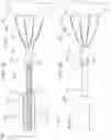 Fig. 48 - Apical Control Of Transvascular Delivery Of Prosthetic Mitral Valve