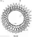 Fig. 02 - Replacement mitral valves