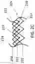 Fig. 06 - Replacement mitral valves