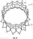 Fig. 07 - Replacement mitral valves