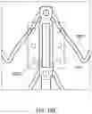 Fig. 43 - Replacement mitral valves