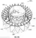 Fig. 45 - Replacement mitral valves