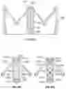 Fig. 71 - Replacement mitral valves
