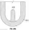 Fig. 76 - Replacement mitral valves
