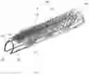 Fig. 02 - IMPLANTS THAT FACILITATE TISSUE EXPANSION