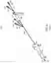Fig. 33 - Devices and methods for placing a gastrointestinal device