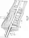 Fig. 37 - Devices and methods for placing a gastrointestinal device