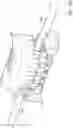 Fig. 52 - Devices and methods for placing a gastrointestinal device