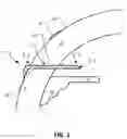 Fig. 02 - DRY EYE TREATMENT DEVICES AND METHODS