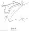 Fig. 04 - System and method for clearing an obstruction from the path of a surgical laser