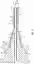 Fig. 04 - Disposable speculum with adhesive surface