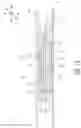 Fig. 13 - ABSORBENT ARTICLE WITH BODY CONFORMING STRUCTURE
