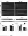 Fig. 06 - Compositions and Methods Relating to p62 for the Treatment and Prophylaxis of Age-Related Macular Degeneration