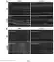 Fig. 07 - Compositions and Methods Relating to p62 for the Treatment and Prophylaxis of Age-Related Macular Degeneration