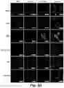 Fig. 08 - MITOCHONDRIAL COPPER DEPLETION REPROGRAMS THE METABOLISM OF TRIPLE NEGATIVE BREAST CANCER