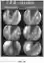 Fig. 49 - Compositions comprising silk fibroin particles and uses thereof