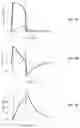 Fig. 20 - Clinical decision support system for patient-ventilator asynchrony detection and management