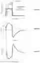 Fig. 21 - Clinical decision support system for patient-ventilator asynchrony detection and management