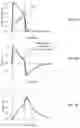 Fig. 23 - Clinical decision support system for patient-ventilator asynchrony detection and management