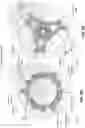 Fig. 08 - Vessel gripper