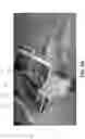 Fig. 02 - Medical procedure using augmented reality