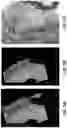 Fig. 07 - Medical procedure using augmented reality