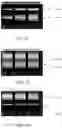 Fig. 15 - Radio frequency match network and generator