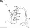 Fig. 02 - Compensating hidden hearing losses by attenuating high sound pressure levels