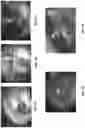 Fig. 02 - System and method of otoscopy image analysis to diagnose ear pathology